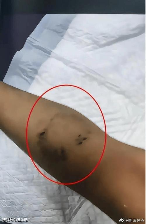 儿童遭父亲殴打致死,小孩被父亲暴打